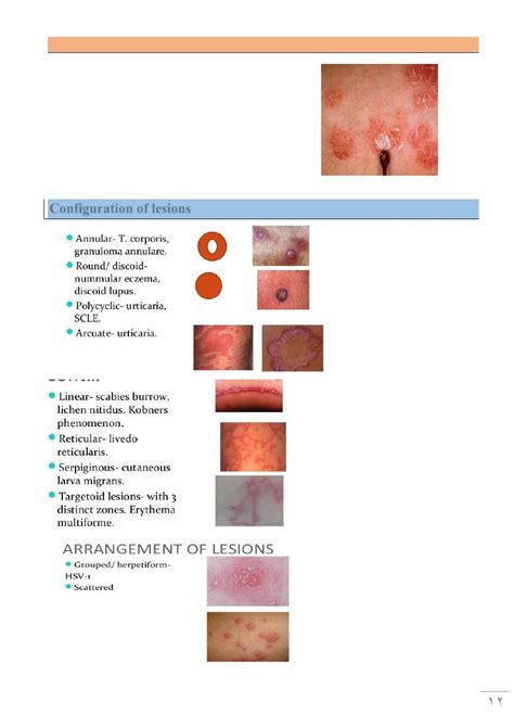 Diagnosis of Skin Diseases pdf - D. Hadf - Muhadharaty