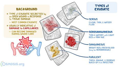 Serosanguineous: What Is It, Appearance, and More | Osmosis