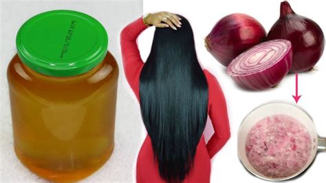 ACEITE DE CEBOLLA CASERO: CRECIMIENTO EXTREMO DEL CABELLO EN 7 DÍAS Y DETENER LA CAÍDA ...