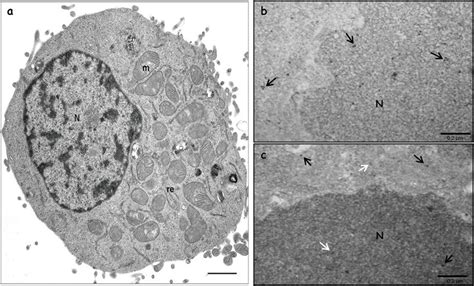 Thin section of HEK293 cell by conventional procedure for electron ...