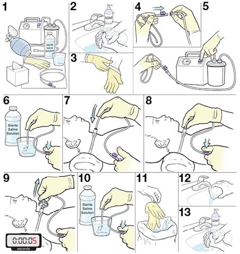 Tracheostomy Suctioning Technique