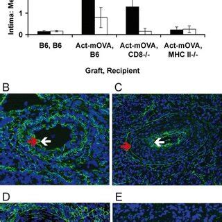 Intimal hyperplasia in Act-mOVA versus B6 heart grafts from CD8+ T ...