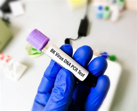 Premium Photo | Molecular biologist holding blood sample for Bk virus DNA PCR test.