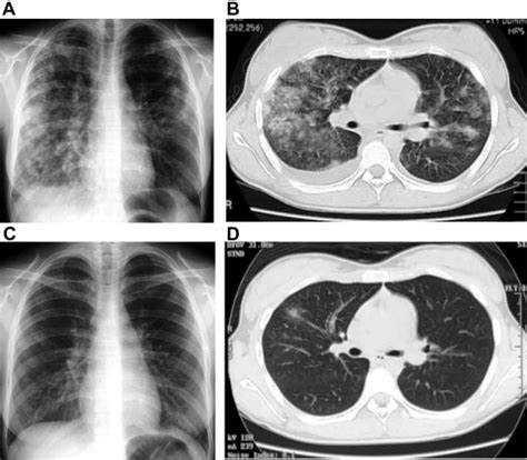 7 Differences Between X Ray And CT Scan - Deep Medical Centre