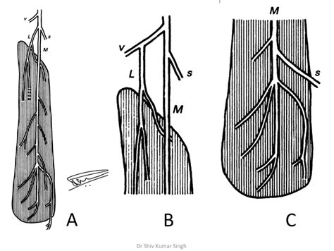 Peripheral nerve stimulator (PNS) guided adductor canal block: A novel approach to regional ...