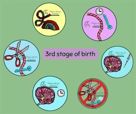 Delayed cord clamping? Options for umbilical cord clamping.