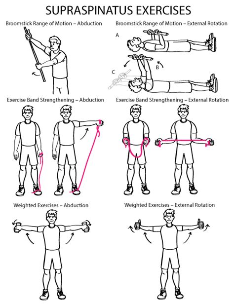 Pin on Rotator cuff repai