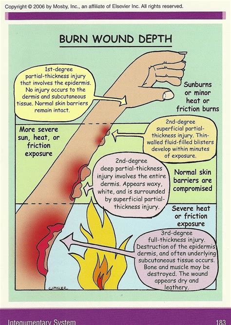 Burn Wound Depth Infographic #nursingstudents #nurseeducator #nursecollab | Nursing school notes ...