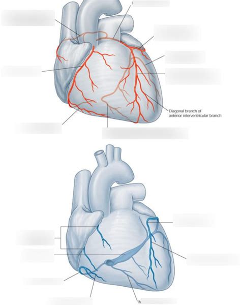 Printable Coronary Artery Diagram