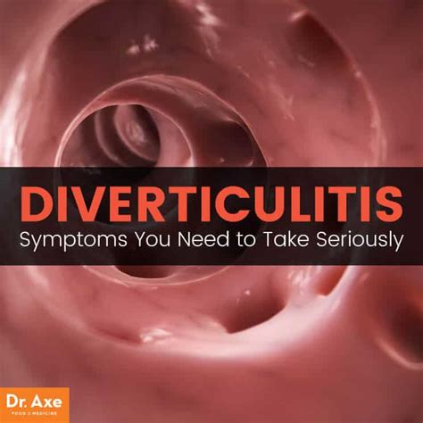 Diverticulitis Symptoms You Can Treat Naturally - Dr. Axe