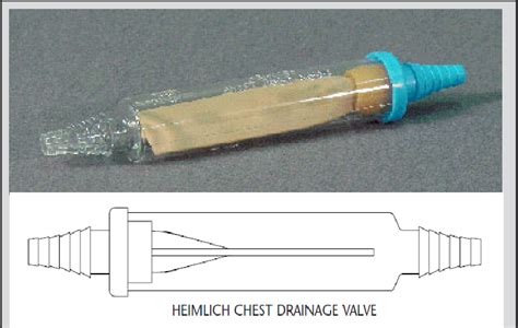 Heimlich Chest Drain Valve - Best Drain Photos Primagem.Org