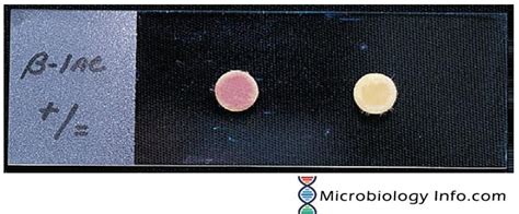 Beta Lactamase Test - Principle, Procedure, Uses and Interpretation