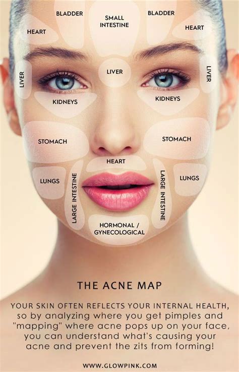 The #Acne face map | Face mapping, Face mapping acne, Face acne