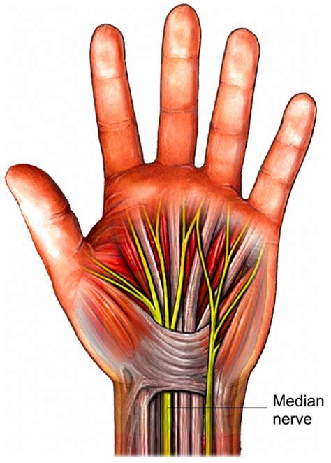 Carpal Tunnel Syndrome – Aberdeen Virtual Hand Clinic