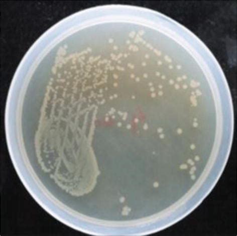 Escherichia coli: An Overview of Main Characteristics | IntechOpen