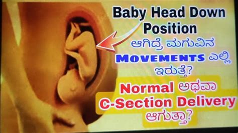 BABY HEADDOWN POSITION|BABY DROPPING|CEPHALIC POSITION Symptoms DURING PREGNANCY - YouTube