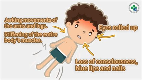 Febrile Seizure Symptoms