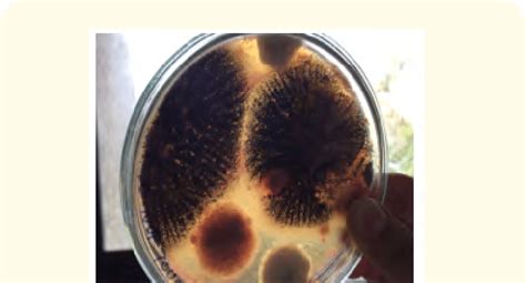 a): Fungi from Bread. | Download Scientific Diagram