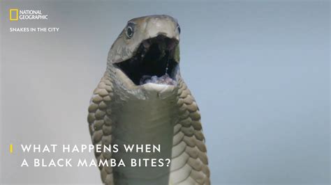 Black Mamba Bite Symptoms