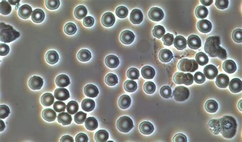 What Is Phase Contrast Microscopy?