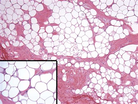 Head and Neck Pathology | Ento Key