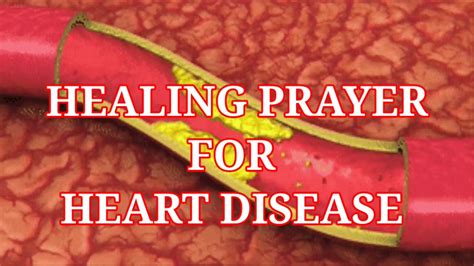 POWERFUL HEALING PRAYER FOR THOSE SUFFERING FROM HEART DISEASE - YouTube