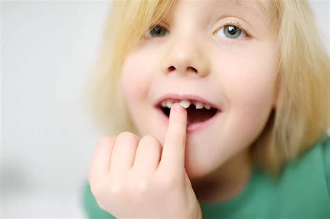 Missing Permanent Teeth (Hypodontia): Causes, Treatments & Impact