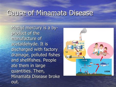 Minamata Disease