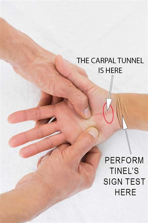 Self Test For Carpal Tunnel | The Carpal Solution