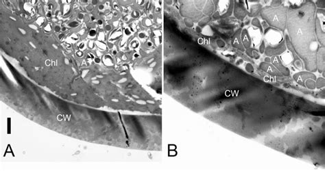 Transmission electron microscope images of the ultrastructure of the... | Download Scientific ...