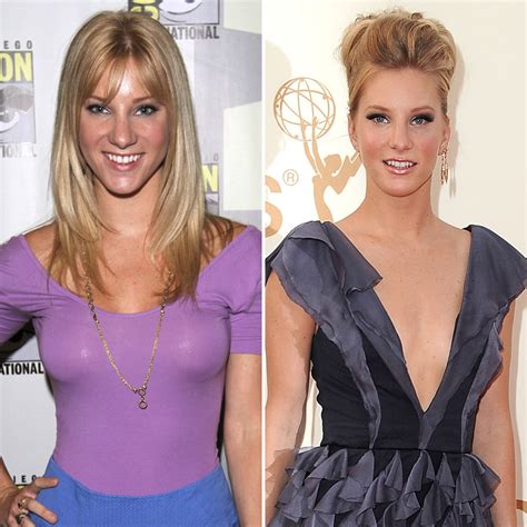 Celebrities Who Removed Their Breast Implants— Before-and-After Pics