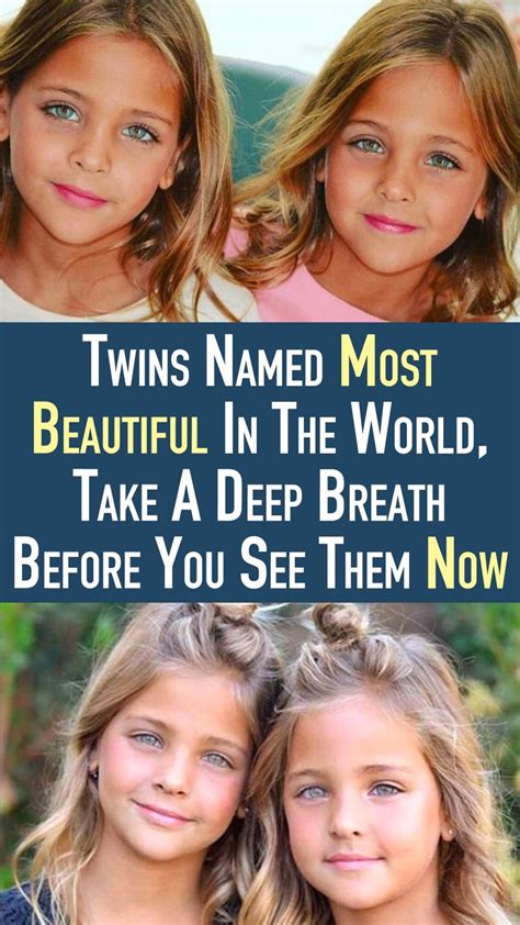 Twins Named Most Beautiful In The World, Take A Deep Breath Before You ...