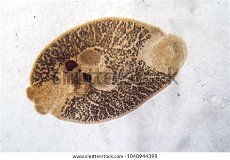 Flukes Infestation Parasite Under Microscope View Stock Photo (Edit Now ...