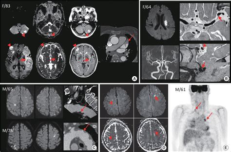 Figure 1 from Applications of diffusion-weighted imaging in diagnosis ...