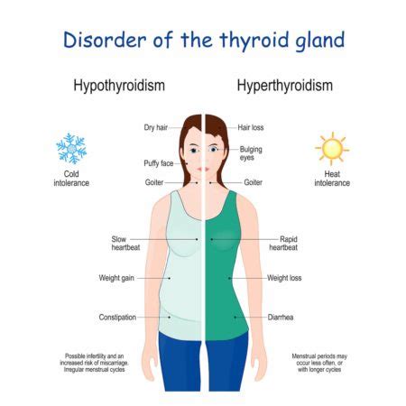 disorder of thyroid gland - Rocky Mountain Diabetes Center