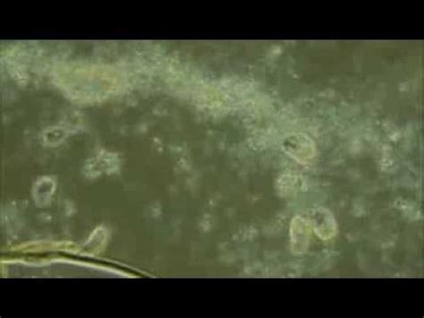 Microaerophilic Bacteria - YouTube