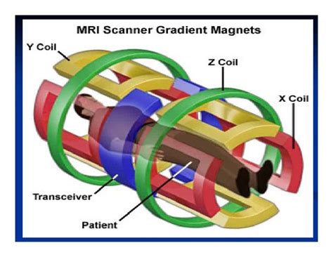 Inside the MRI: Gradient Coils | Amber Diagnostics