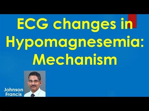 ECG changes in Hypomagnesemia Mechanism - YouTube