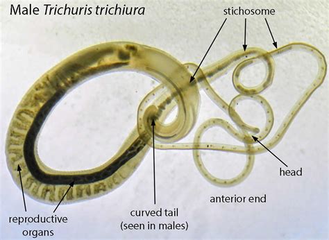 Whipworm in humans symptoms, prevention, diagnosis & whipworm treatment