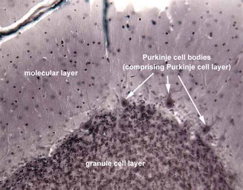 Purkinje Cells Histology