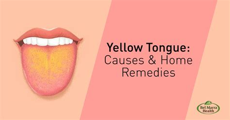 10 Common Causes and Treatments for Yellow Tongue