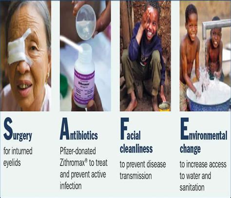 Trachoma - Causes, Symptoms, Treatment, Diagnosis and Prevention ...