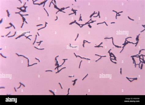 This micrograph depicts the gram-positive bacterium Bifidobacterium eriksonii grown in ...