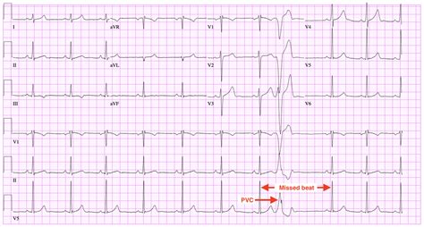 I learned a lot about the heart over the last 2 weeks, and discovered an amazing similarity ...