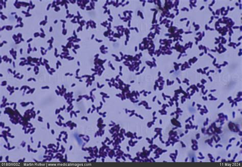 STOCK IMAGE, photomicrograph of corynebacterium diphtheriae the cause ...