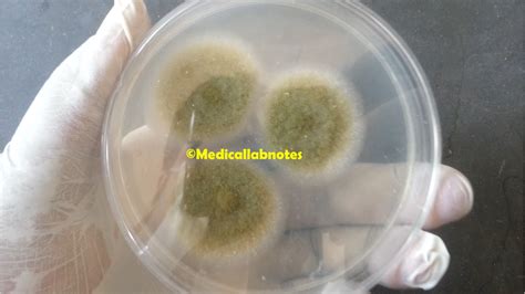 Aspergillus niger colony morphology on PDA Archives - Medical Notes