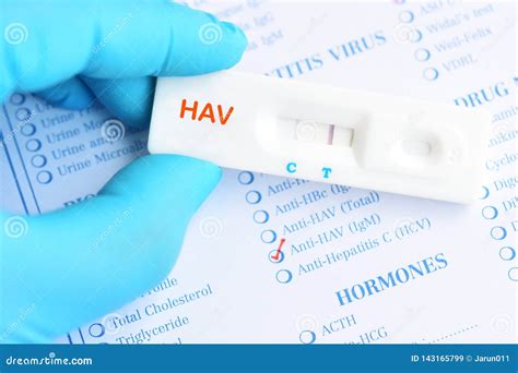 Hepatitis a Virus Positive Test Result Stock Image - Image of reactive, analyzing: 143165799