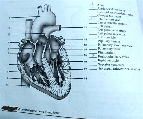 SOLVED: Aorta Aortic semilunar valve Bicuspid atrioventricular valve Chordae tendineae Inferior ...