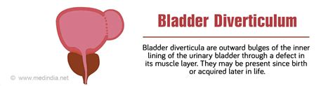 Bladder Diverticulum - Causes, Symptoms, Diagnosis and Management