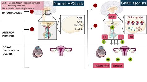 Gonadotropin-releasing hormone (GnRH) agonists - YouTube